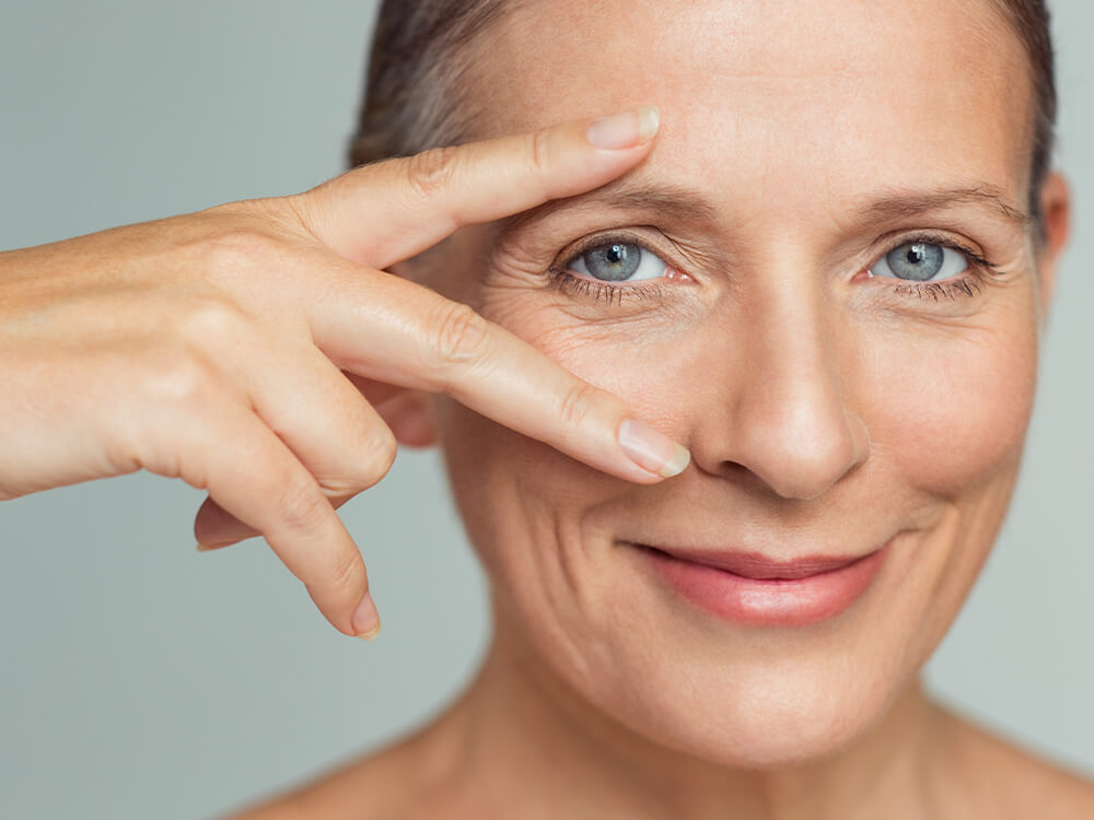 Vorher Nachher Bilder zur Augenlidstraffung