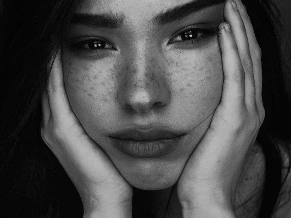 Vorher Nachher Bilder zu Bullhorn Lift