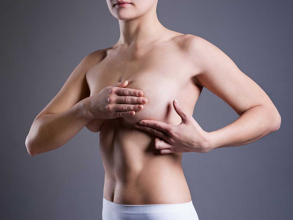 Vorher Nachher Bilder zu Mammatubuläre Deformität